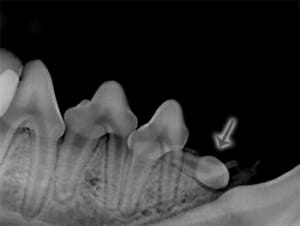 X-ray image of teeth with an arrow pointing at the missing tooth