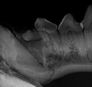 Radiograph of Florence's lower canine teeth