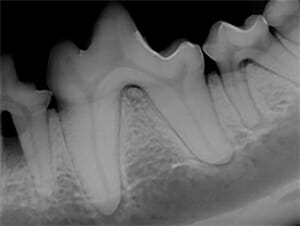 Dental radiograph