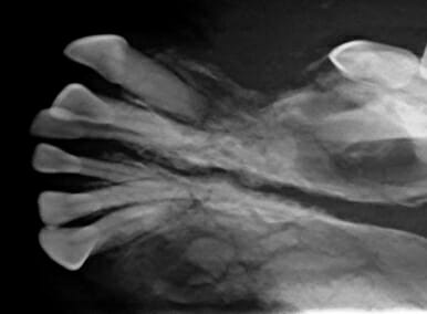 X-ray image