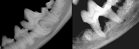 Dental x-ray image