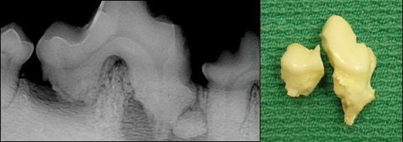 A dental radiograph and actual photograph of the same tooth after extraction