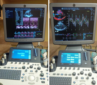 Cardiology equipment and monitor