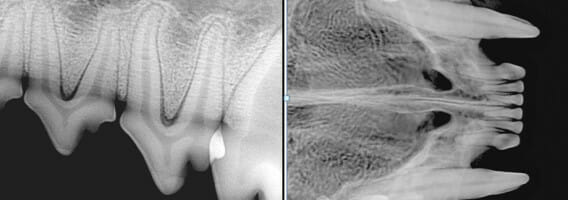 X-ray images of teeth