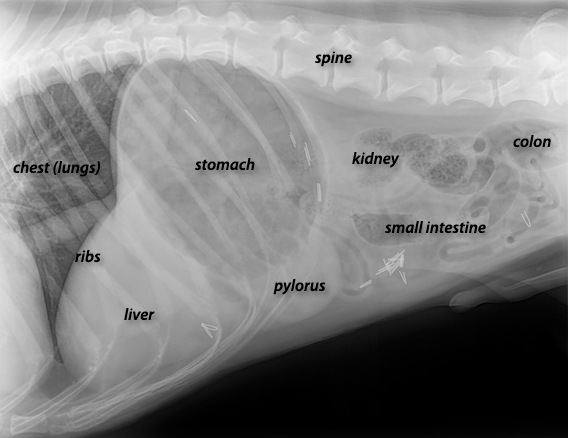 X-ray image of a normal abdomen labelled with names of the organs